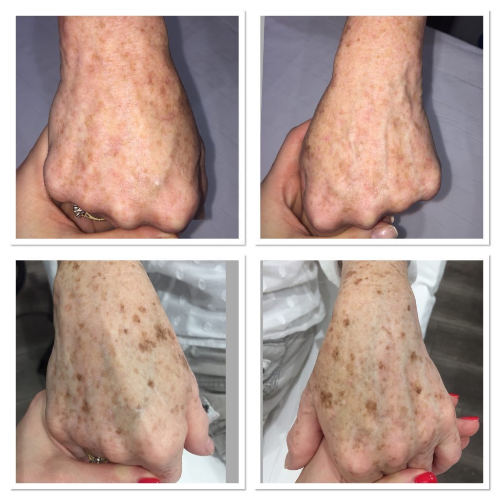 Pigmentation-Middlesbrough